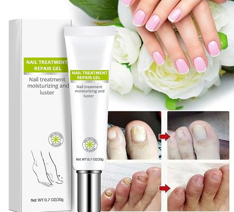 Gel pour les ongles EFERO YT 2