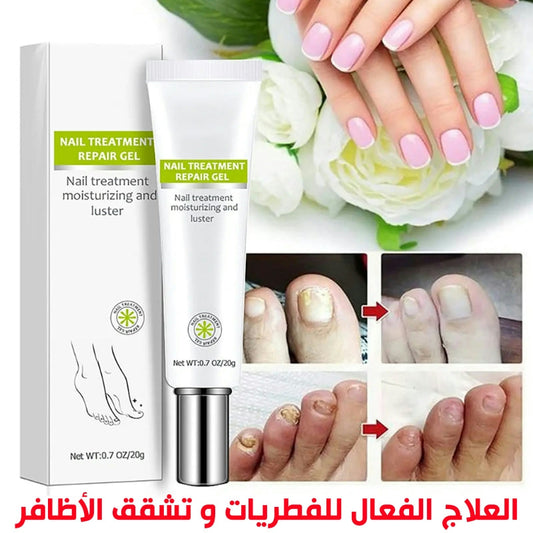 Gel pour les ongles EFERO KT